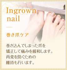 巻き爪ケア　巻き込んでしまった爪を矯正して痛みを緩和します。再発を防ぐための維持も行います。