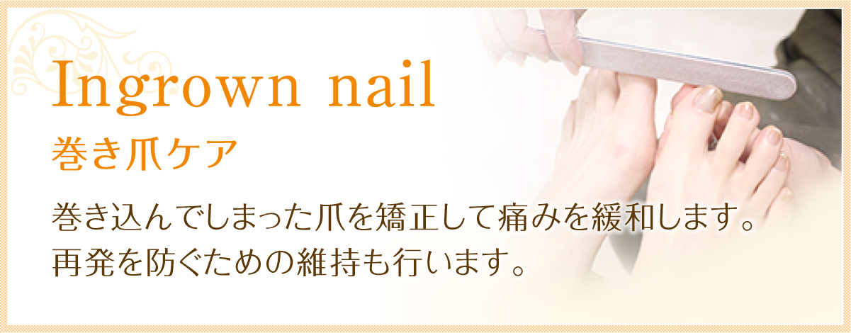 巻き爪ケア